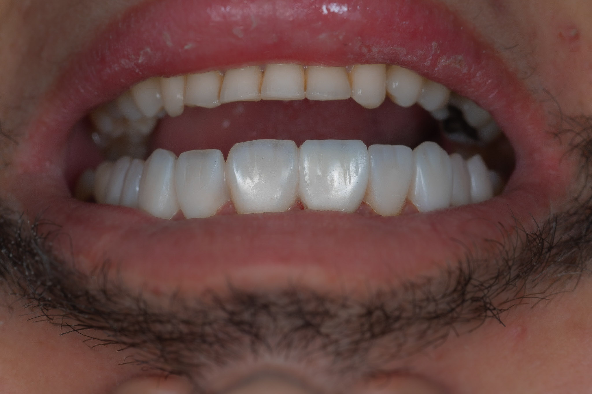 Sorriso depois do tratamento realizado